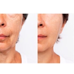 Medi-Peel-Peptide-9-Volume-Lifting-Mask4