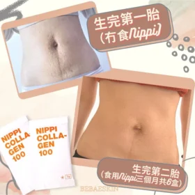 Nippi collagen-1