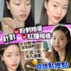 Pios Supreme Instant Spots Remover 瞬時去痘淨膚精華 10ml