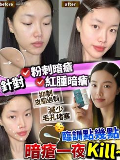 Pios Supreme Instant Spots Remover 瞬時去痘淨膚精華 10ml