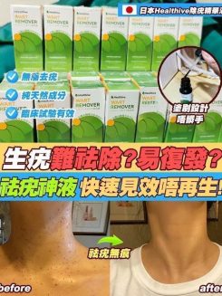 日本Healthive除疣無印非藥性精華液🇯🇵