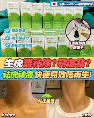 日本Healthive除疣無印非藥性精華液🇯🇵