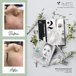 韓國sMTS水光粒子(家用版嬰兒針)1盒5次(5支晶體破尿酸精華+5片強效補水面膜)